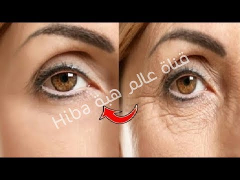 لايف ستايلشاهد: كريم ليلي للتخلص من انتفاخات العين95695/0