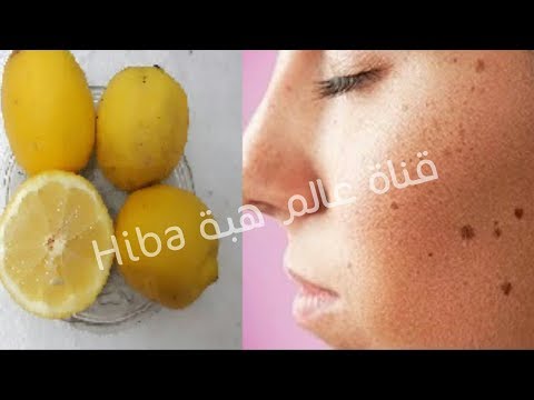 لايف ستايلكيفية استخدام الليمون للتخلص من البقع الداكنة95696/0