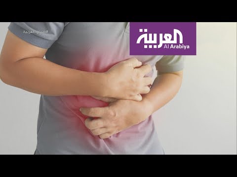 لايف ستايلشاهد: السبب الحقيقي وراء انتفاخ البطن وكيفية التخلص منه109343/0