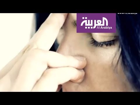 لايف ستايلشاهد: تعرف على أسباب الانحراف الأنفي وعلاجاته111390/0