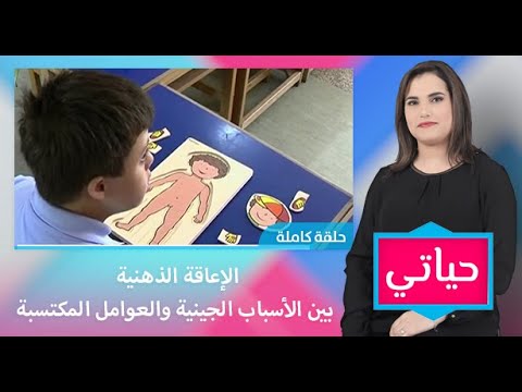 لايف ستايلشاهد:أخصائيون يكشفون أسباب الإعاقة الذهنية لدى الأطفال116387/0