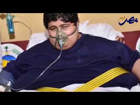 لايف ستايلشاهد: السمنة ترفع خطر الإصابة بسرطان القولون122778/0