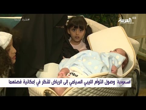 لايف ستايلشاهد: وصول التوأم السيامي الليبي إلى السعودية لفصله145269/0