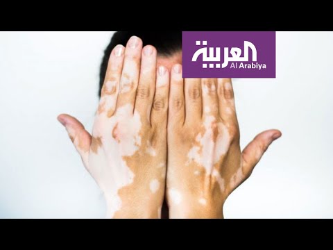 لايف ستايلشاهد: نصيحة من طبيب للفنان رامي جمال150011/0