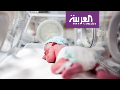 لايف ستايلشاهد: 15 مليون طفل يولدون قبل الأوان سنويًا150012/0