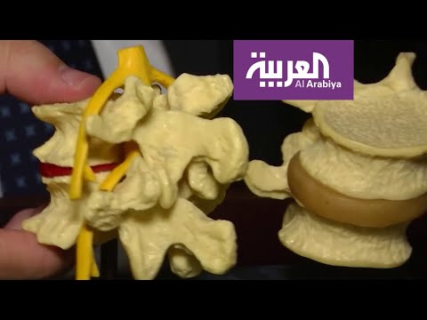 لايف ستايلشاهد: إيطاليا تنجح في زراعة فقرات من عمود فقري150581/0