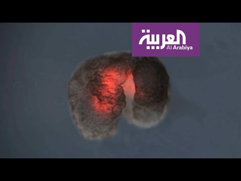 لايف ستايلشاهد: اختراع جديد لقتل الخلايا السرطانية160438/0