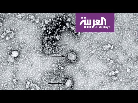 لايف ستايلشاهد: آخر حصيلة لضحايا "كورونا"161823/0