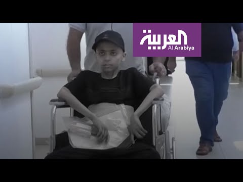 لايف ستايلشاهد: مأساة حزينة لشاب عراقي دفع ثمن الإهمال الطبي167070/0