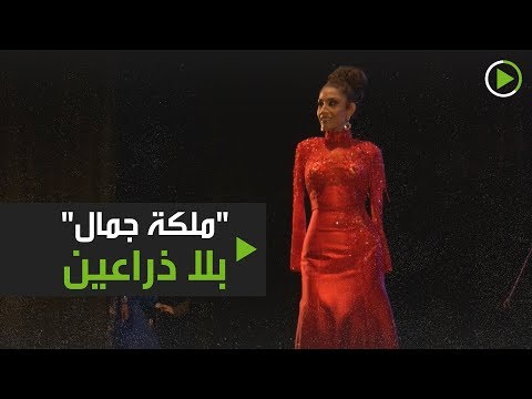 لايف ستايلشاهد: "ملكة جمال" بلا ذراعين في "فيراكروز"168074/0