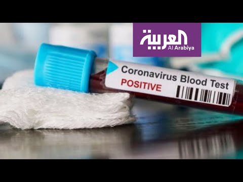 لايف ستايلشاهد: كيف نتعامل مع الأطفال في ظل انتشار "كورونا"؟168731/0