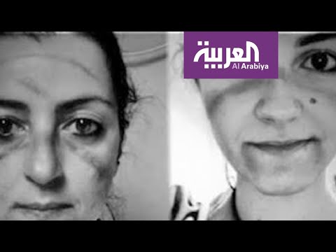 لايف ستايلشاهد: صور هزت مواقع التواصل لأطباء خارت قواهم في معركة "كورونا"170083/0