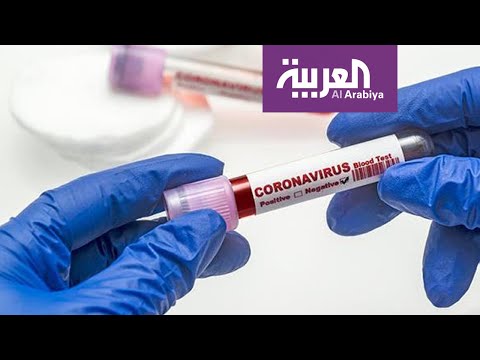 لايف ستايلشاهد: فرص نجاح استخدام بلازما المتعافين من "كورونا" في علاج الإصابات الجديدة171163/0