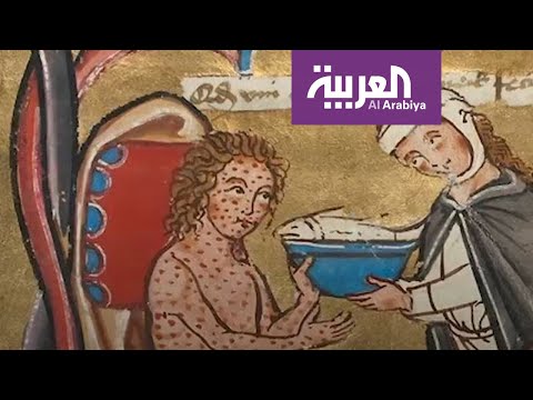 لايف ستايلشاهد: مرض مرعب ضرب العالم أشد من "كورونا"171703/0
