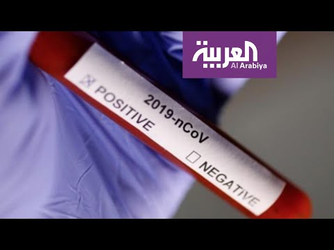 لايف ستايلشاهد: خبير يكشف التشابه بين أعراض كورونا والإنفلونزا171709/0