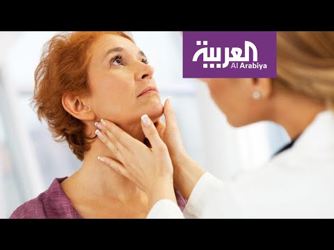 لايف ستايلشاهد: هل هناك مرضى أصيبوا وتعافوا ولم تظهر عليهم أعراض "كورونا"؟173217/0