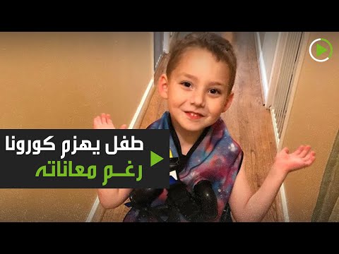 لايف ستايلشاهد: طفل محارب للتليف الكيسي يهزم "كورونا"173428/0