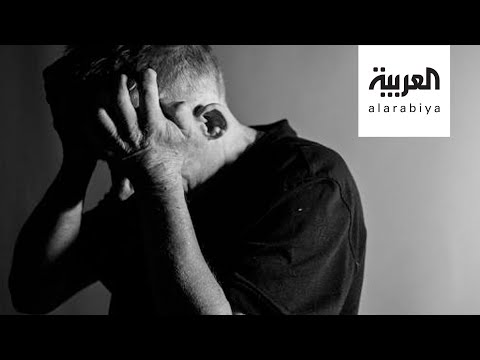 لايف ستايلشاهد: تغيير نمط الحياة يساعد من يعانون أمراضا عقلية على البقاء لفترة أطول176491/0