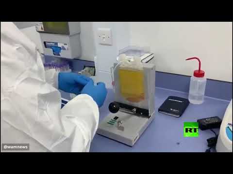 لايف ستايلشاهد: الإمارات تعلن اكتشاف علاج مبتكر لـ"كورونا" بنتائج واعدة176637/0