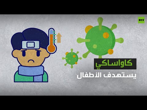 لايف ستايلشاهد: مرض غامض يستهدف الأطفال ما دون الخامسة كثرت حالاته في زمن "كورونا"177496/0