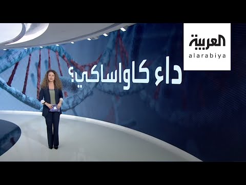 لايف ستايلشاهد: لماذا عاد مرض كاواساكي ليصيب أطفال العالم بالتزامن مع "كورونا"؟178703/0