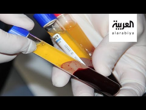 لايف ستايلشاهد: مصر تحث المتعافين من "كورونا" على التبرع بـ"البلازما"184243/0