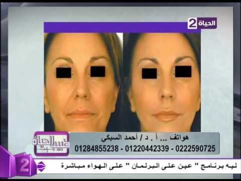 لايف ستايلشاهد: حقن الوجه بالفيلر بدون بنج أو ألم19760/0