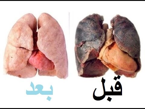 لايف ستايلشاهد: طريقة بسيطة لتنظيف الرئة من النيكوتين والسموم22664/0