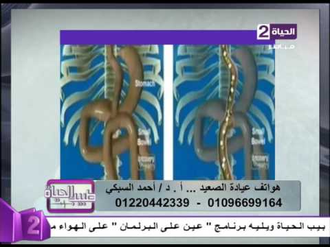 لايف ستايلشاهد: الفرق بين عملية تحويل المسار القديمة والحديثة22682/0