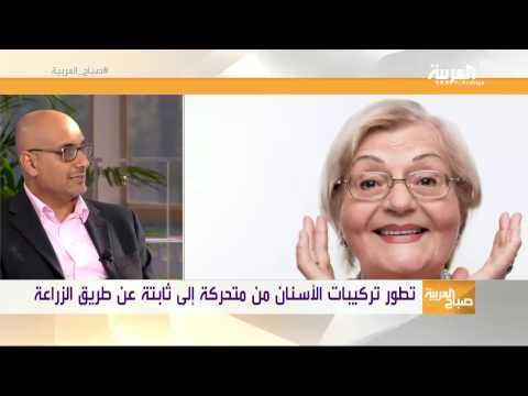 لايف ستايلشاهد: تطور تركيبات الأسنان من متحركة إلى ثابتة عن طريق الزراعة23386/0