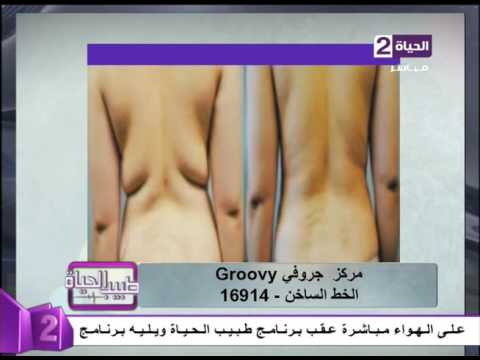 لايف ستايلبالفيديو: نتائج مبهرة بعد إستخدام الفيزر للتنحيف24581/0