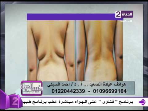 لايف ستايلشاهد: نتائج مبهرة بعد التخلص من الدهون بالفيزر27905/0