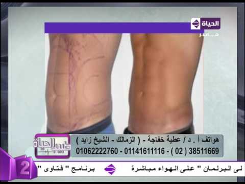 لايف ستايلبالفيديو: نتائج مبهرة بعد التخلّص من السمنة الزائدة28125/0