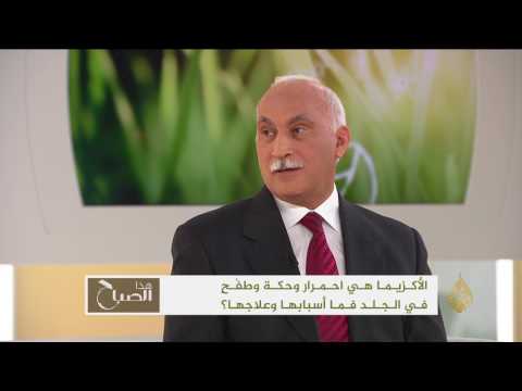 لايف ستايلبالفيديو: عادل كمال يؤكّد أن الأكزيما تشمل العديد من الأمراض الجلدية32695/0