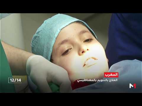 لايف ستايلشاهد: التنويم المغناطيسي طريقة حديثة يعتمد عليها الأطباء37421/0
