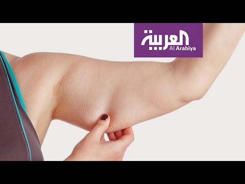 لايف ستايلشاهد: أحدث طريقة لإزالة الجلد المترهل37707/0