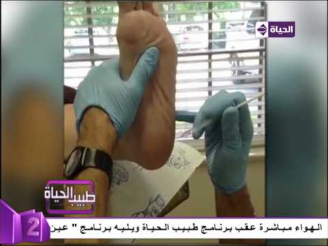 لايف ستايلبالفيديو: كيفية علاج الشوكة العظمية للمريض38332/0