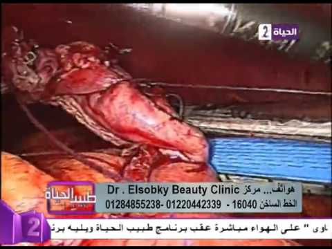 لايف ستايلبالفيديو: شرح بسيط لعملية تحويل المسار بالمنظار38994/0