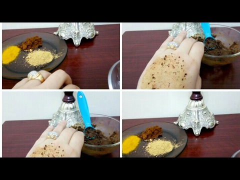 لايف ستايلوصفة رائعة لعلاج الخطوط البيضاء بعد الولادة40105/0