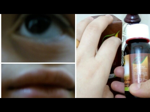 لايف ستايلأفضل وصفة للتخلص من الهالات السوداء40986/0