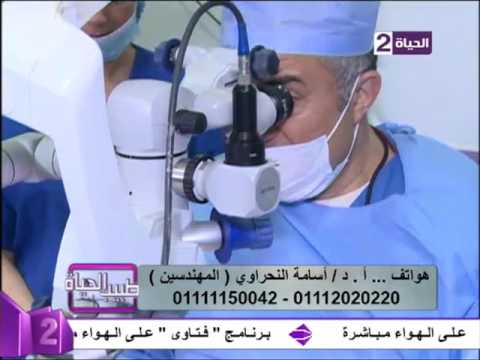 لايف ستايلبالفيديو: عملية إزالة المياه البيضاء وزرع عدسة وعلاج قصر النظر41074/0