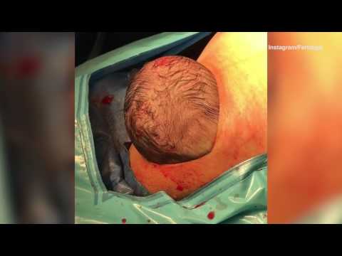 لايف ستايلشاهد: رأس الطفل يخرج من بطن والدته41672/0