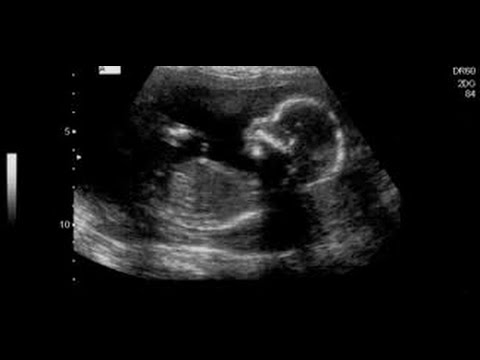 لايف ستايلشاهد: ماذا يحدث للجنين عند أكل البيض ؟42971/0