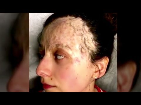 شاهد امرأة خسرت وجهها فوضعت مالكياج