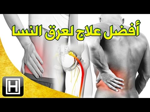 بالفيديو أفضل طريقة لمعالجة عرق النسا