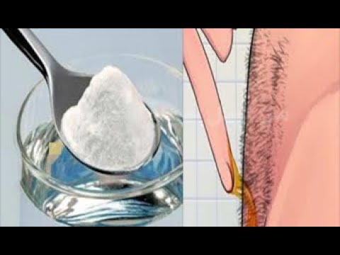 بالفيديو  وصفة للتخلص من شعر الإبطين ومنع نموه