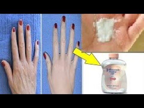 طريقة مجنونة لعلاج تجاعيد اليدين واسمرارها