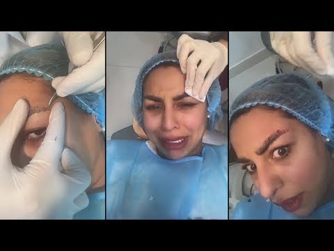 هند البلوشي تجري عملية تعديل للحواجب