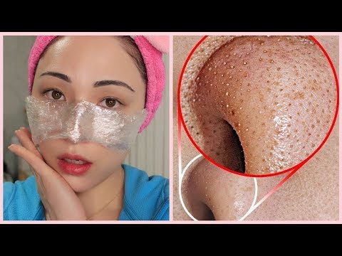 الطريقه الكوريه لإزالة الرؤس السوداء