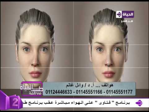 فيديو يوضّح كيفية تنفيذ عملية تجميل الأنف